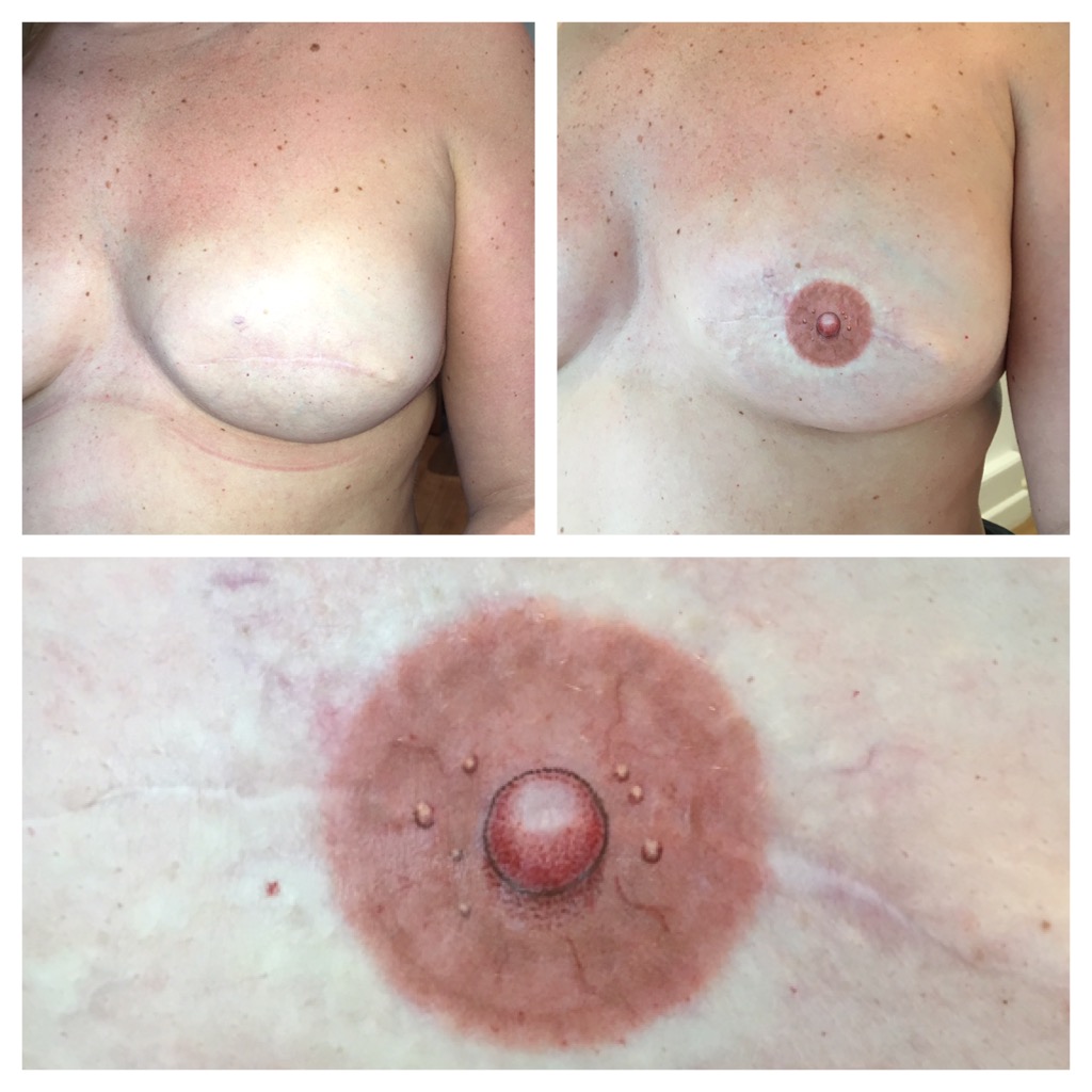 This is the close up image of Vicky's 3D areola see all the detail of the 'montgomeries' and bumpiness of the nipple thus providing a 3D effect, and being part of the end of a long tough journey for this lovely lady in Reading Berkshire